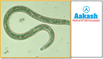  Ancylostoma duodenale