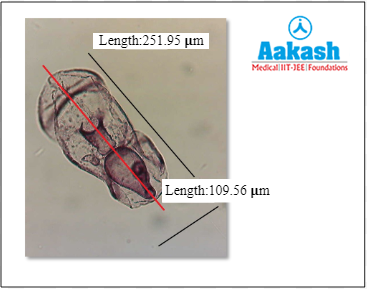 Bilateral symmetry in larva of echinoderms