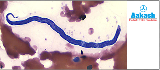  Loa loa (African eye worm)