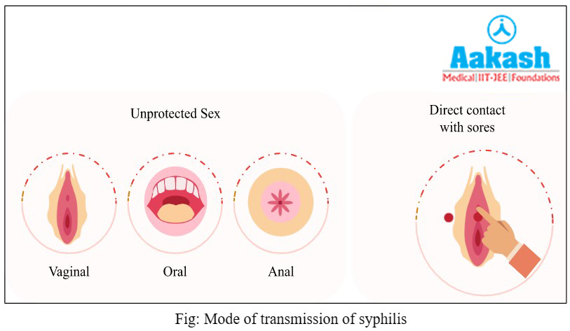 Mode of trannsmission of syphilis diagram