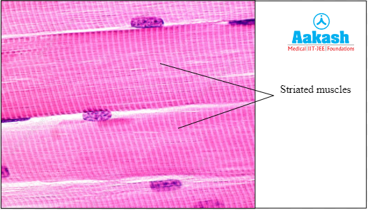 Skeletal muscle tissue