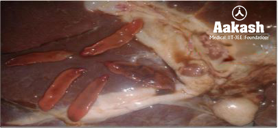 Endoparasite diagram 