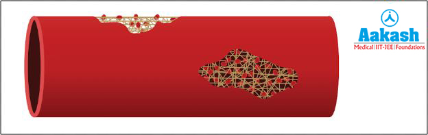 A blood vessel with sealed wounds