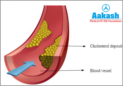 Blood cholesterol