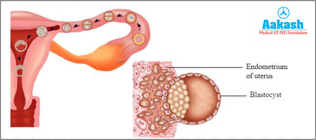Site of Implantation