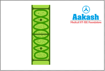 Chloroplast in Spirogyra