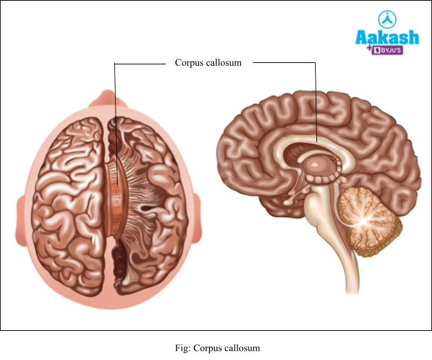 corpus callosum