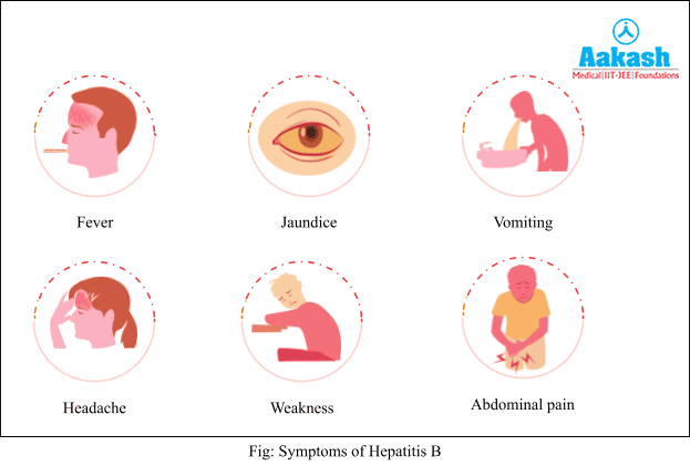Symptoms of Hepatitis B