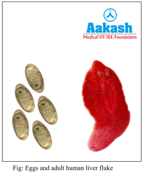 Eggs and adult human liver fluke