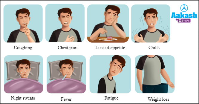 Fig: Common symptoms of pulmonary tuberculosis