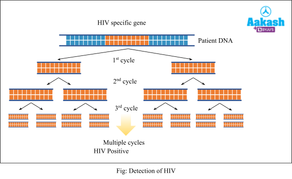 Detection of HIV
