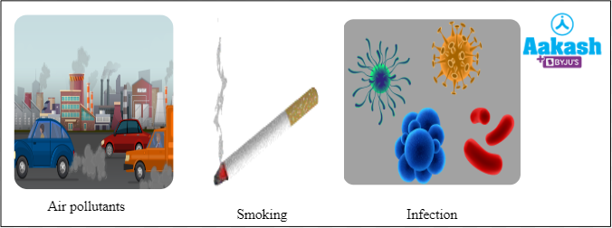 Fig: Causes of chronic bronchitis