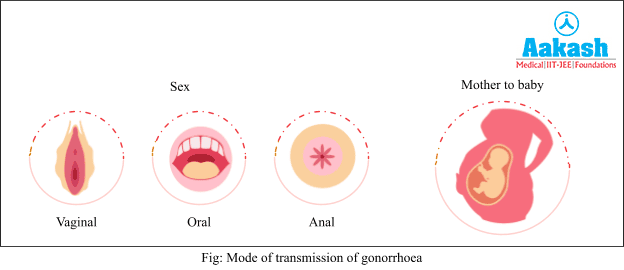 Mode of Transmission of Gonorrhoea