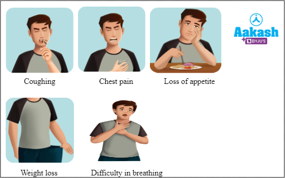 Fig: Common symptoms of bronchogenic carcinoma