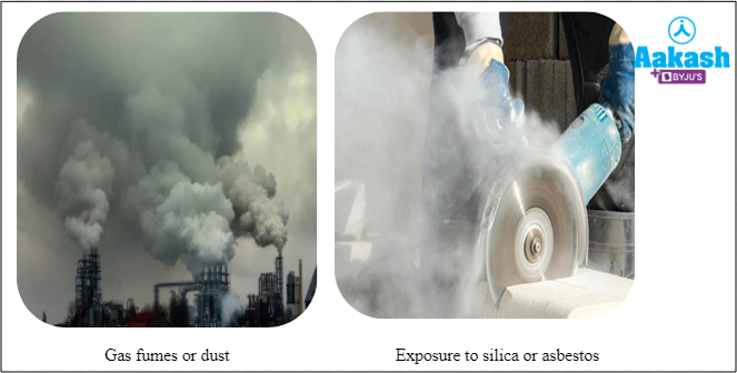 Fig: Causes of occupational respiratory disorders