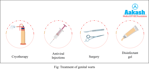 Treatment of Genital Warts