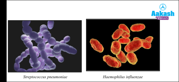Causative agent of pneumonia