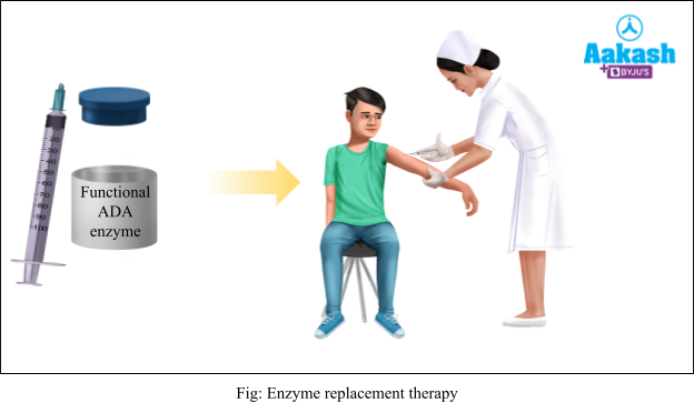  Enzyme replacement therapy