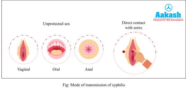 Mode of Transmission of Syphilis