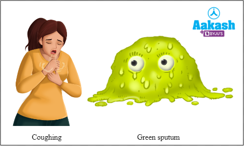 Fig: Common symptoms of chronic bronchitis