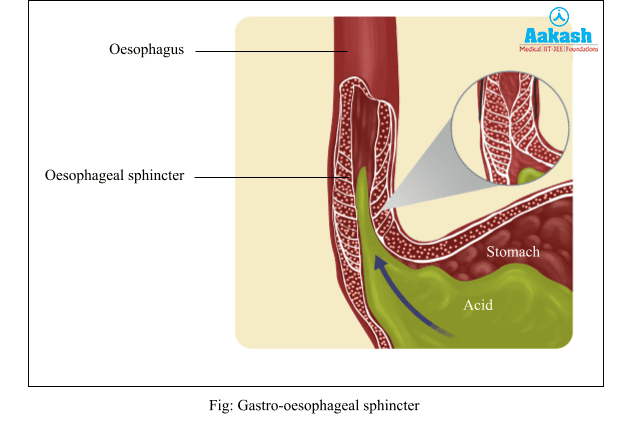  Gastro-oesophageal Sphincter
