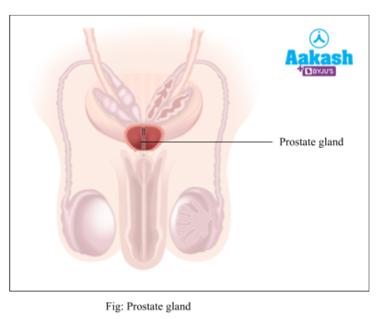 prostate-gland
