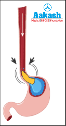 Primary esophageal peristalsis