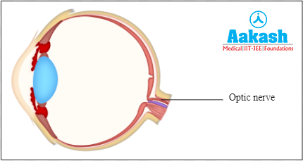 Optic nerve Diagram