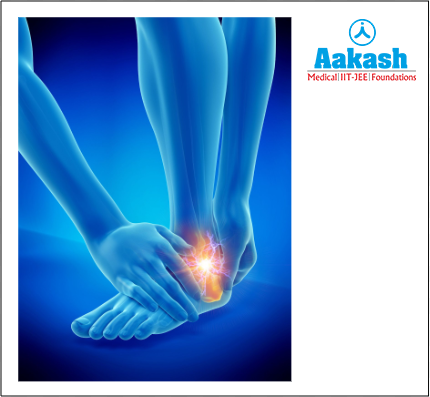 Osteoarthritis in the foot and ankle joint