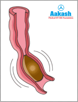 Peristalsis in the large intestine