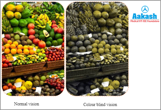 Red green colourblindness