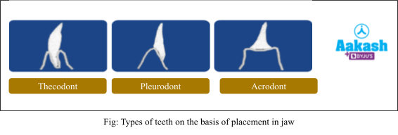 types of teeth on the basis of placement in jaw
